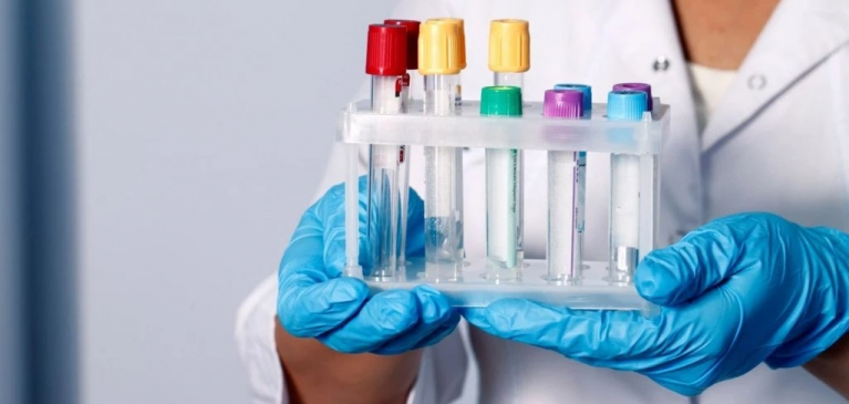 Laboratory tests: Photo
